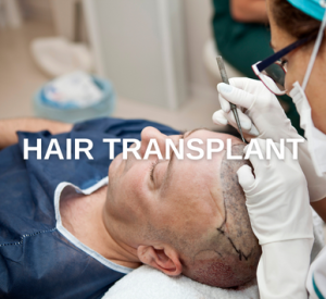 Hair Transplant Trawellmed Health Tourism