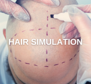 Hair Simulation Trawellmed Health Tourism